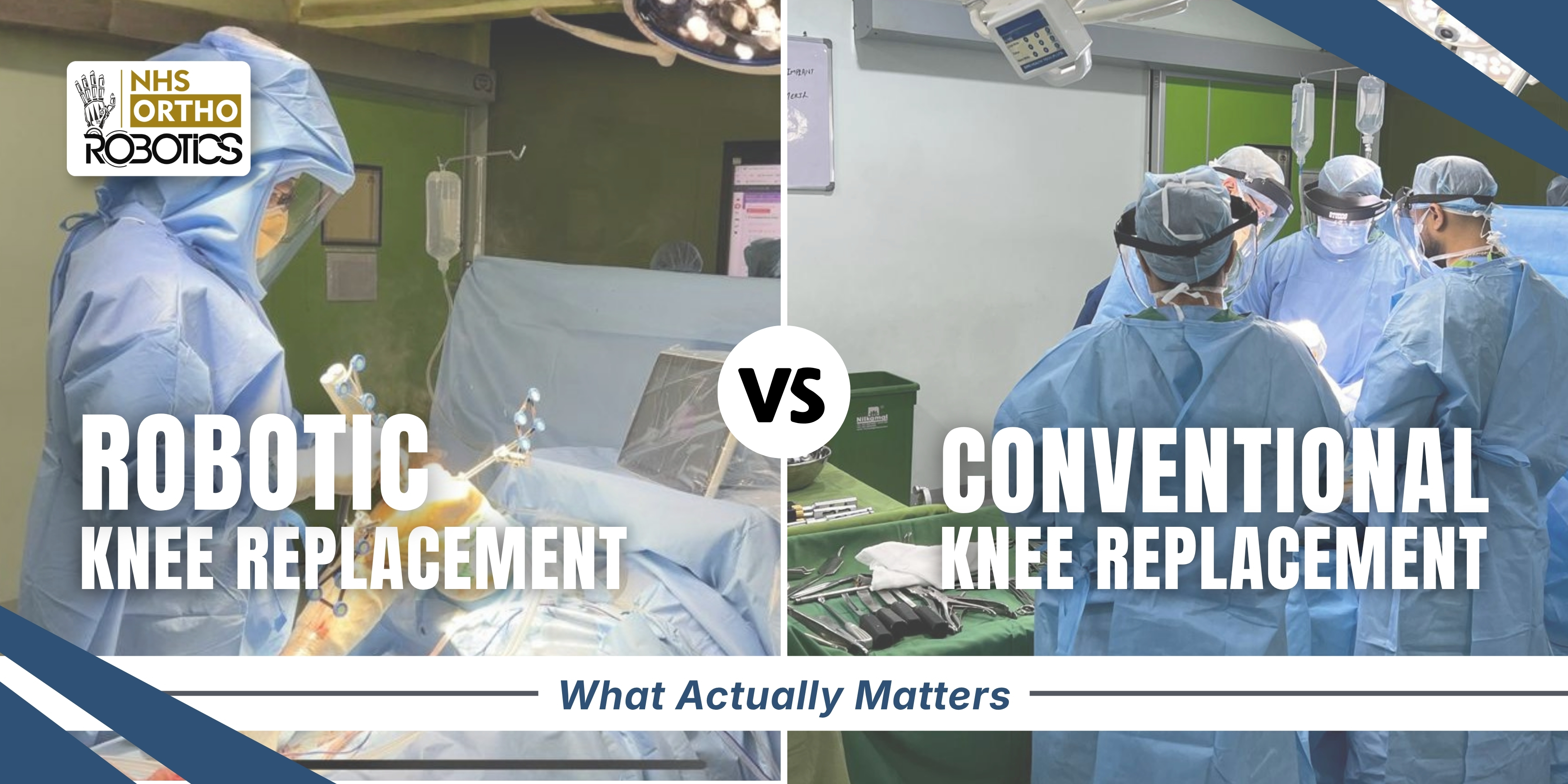 Robotic vs Conventional Knee Replacement – What Actually Matters